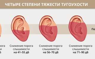 Симптомы неполной потери слуха у взрослых людей