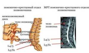 МРТ пояснично-крестцового отдела позвоночника: диагностика и преимущества