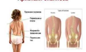 Как укрепить мышцы спины в домашних условиях эффективно и безопасно