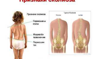 Как укрепить мышцы спины в домашних условиях эффективно и безопасно