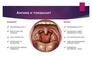 Последствия ангины для здоровья человека