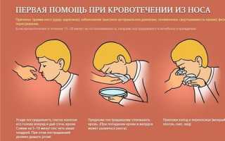 Помощи при носовом кровотечении у ребенка: советы и рекомендации