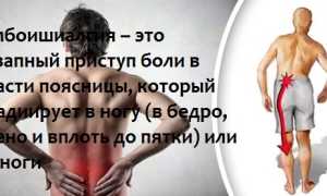 Люмбалгия: что это такое и как с ней бороться?