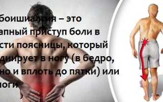Люмбалгия: что это такое и как с ней бороться?