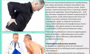 Острая боль в пояснице: как снять симптомы, причины, лечение и профилактика для здоровья