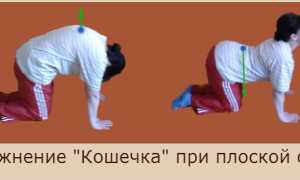 Плоская спина для здоровья и комфорта