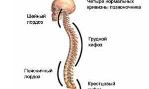 Кифоз позвоночника: причины и лечение