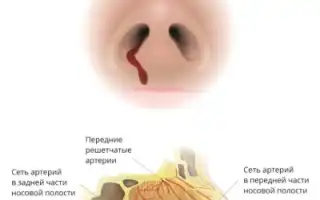 Причины и симптоматика кровотечения в носоглотке: важные аспекты здоровья