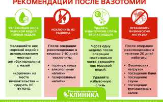 Показания к проведению вазотомии носовых раковин: важные аспекты и рекомендации