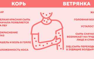 Причины возникновения кашля и болей в горле при ветрянке у детей