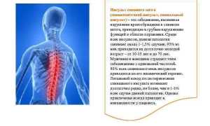 Инсульт спинного мозга: причины и последствия