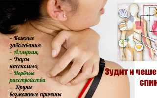 Почему чешется спина: причины и советы