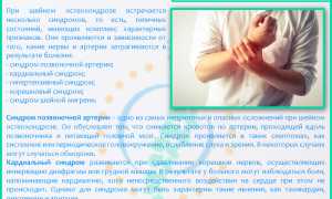 Как избавиться от шейного остеохондроза навсегда и эффективно