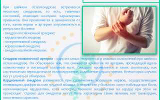 Как избавиться от шейного остеохондроза навсегда и эффективно