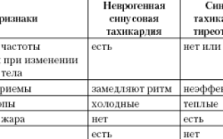 Тахикардия и армия