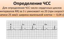 Расшифровка экг для чайников