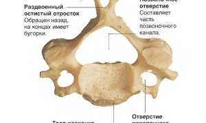 Что такое протрузия дисков позвоночника шейного отдела и как с ней бороться