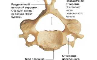 Что такое протрузия дисков позвоночника шейного отдела и как с ней бороться