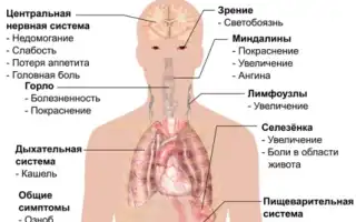 Все, что нужно знать о симптоматике и лечении вируса Эпштейна-Барр для здоровья