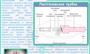 Рентген позвоночника — что показывает и как проводится?