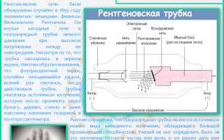 Рентген позвоночника — что показывает и как проводится?