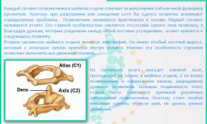 Головокружение при остеохондрозе шейного отдела — лечение и профилактика
