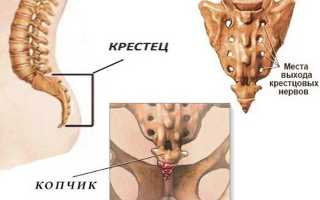 Болит копчик причины у женщин и методы лечения