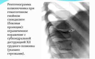 Боль в спине при наклонах: причины и рекомендации