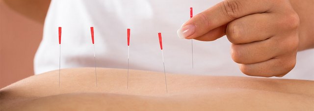 Древнекитайская медицина и поныне стоит на страже здоровья