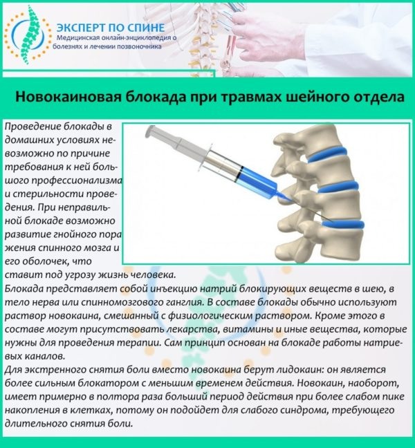 Новокаиновая блокада при травмах шейного отдела