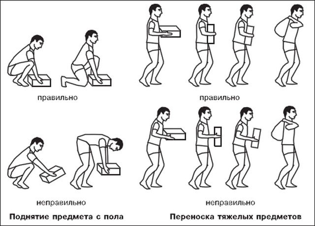 Чтобы избежать возникновения грыжи, поднимать тяжести и переносить их нужно правильно
