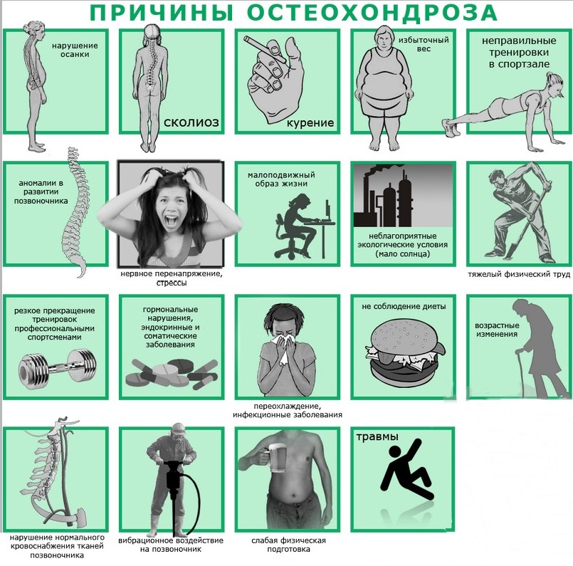 Факторов, способствующих развитию остеохондроза, существует немало