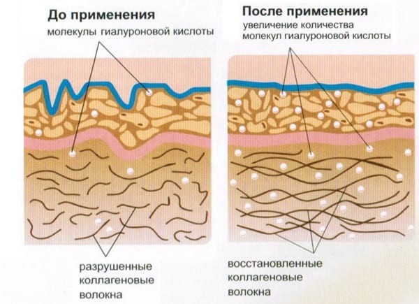Действующие вещества средства быстро и хорошо усваиваются в организме человека, оказывая положительный эффект на состояние хрящей и сосудов, кровообращение