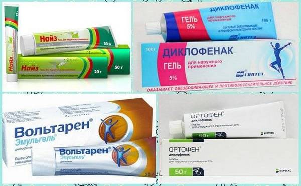 НПВП в виде мазей отлично справляются с болями при хондрозе