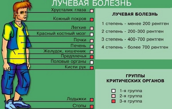 Минус рентгенографии в том, что из-за избыточного облучения может возникнуть лучевая болезнь