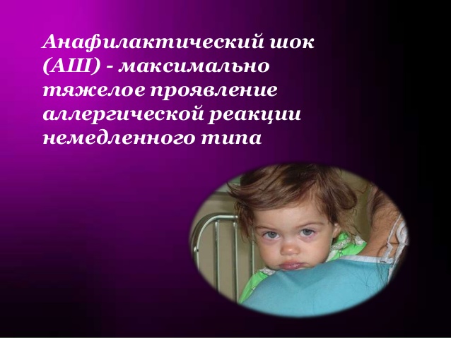 Анафилактический шок