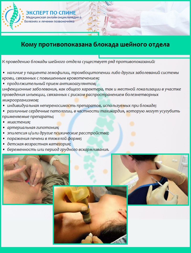 Кому противопоказана блокада шейного отдела