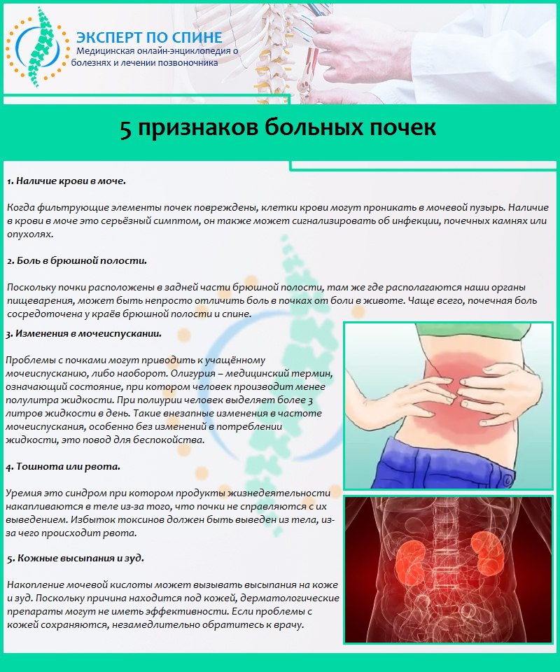 5 признаков больных почек