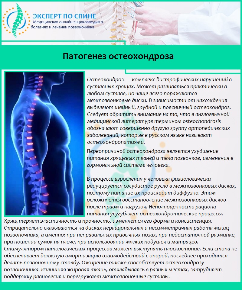 Патогенез остеохондроза