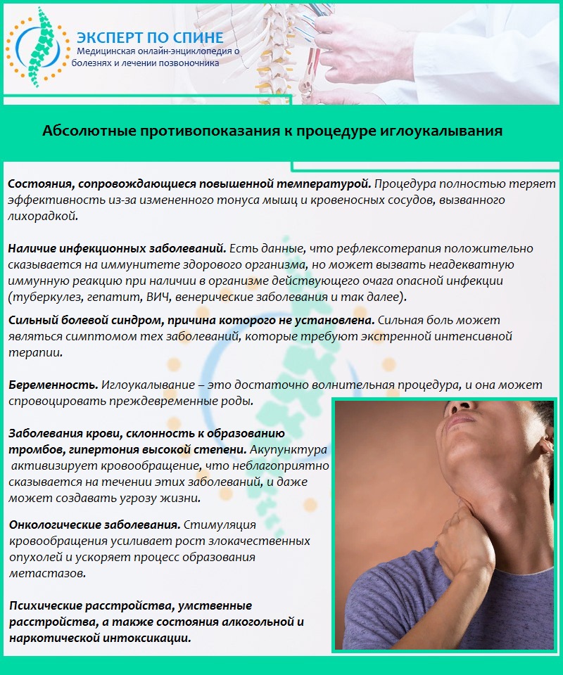 Абсолютные противопоказания к процедуре иглоукалывания