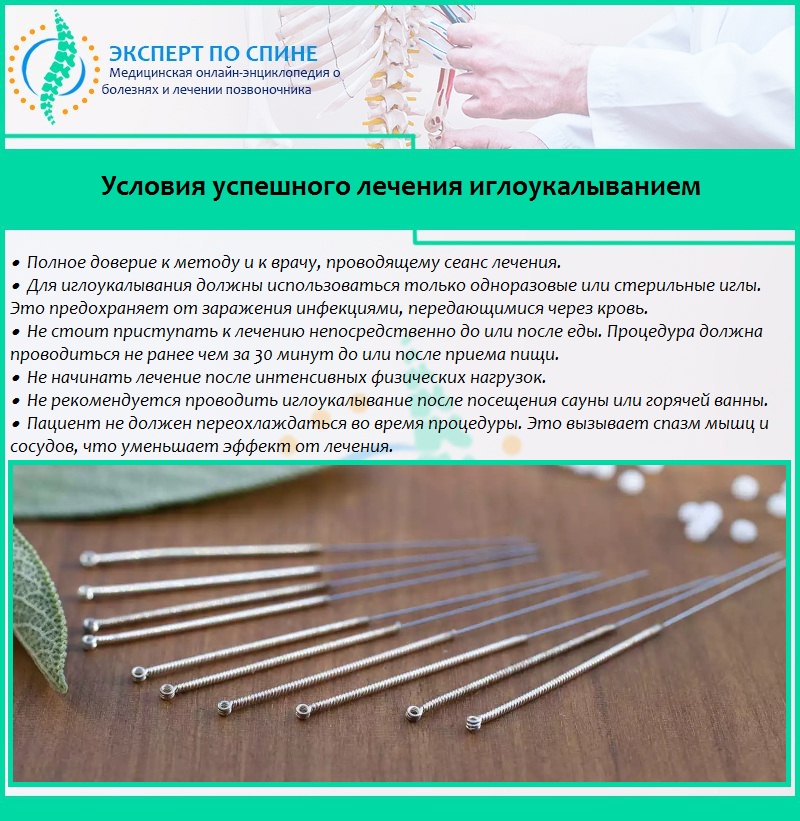 Условия успешного лечения иглоукалыванием