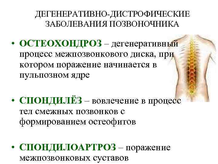Дегенеративно-дистрофические заболевания