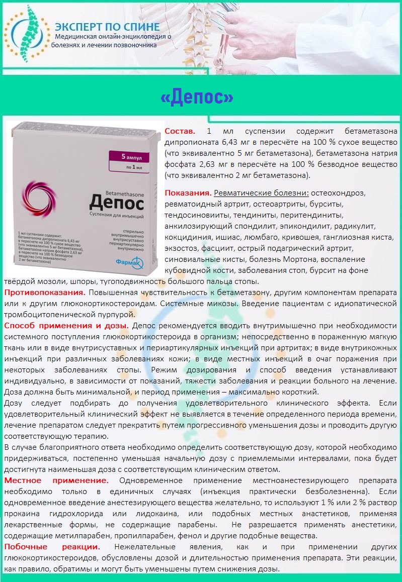 «Депос»