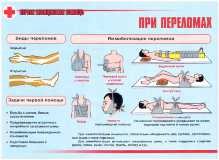 Фиксирование переломов