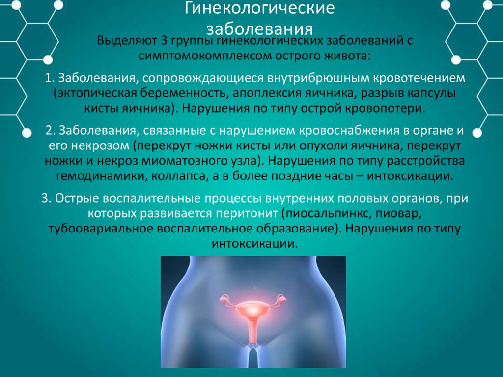Гинекологические заболевания