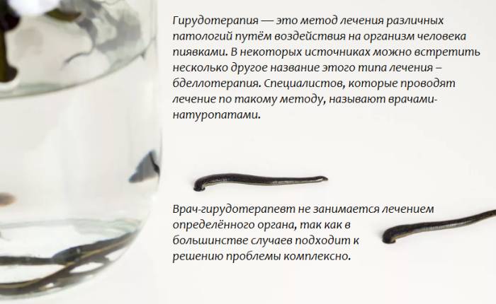 Гирудотерапия