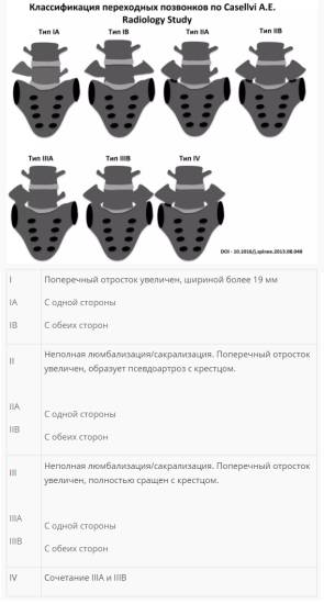 Классификация переходных позвонков
