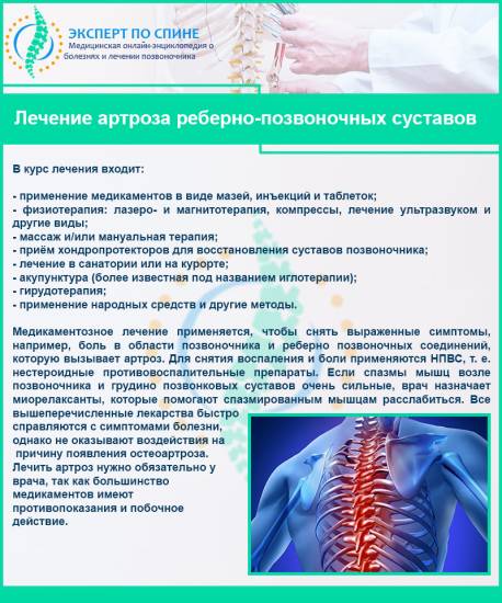 Лечение артроза реберно-позвоночных суставов