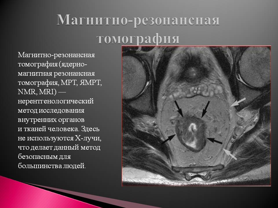Магнитно-резонансная томография