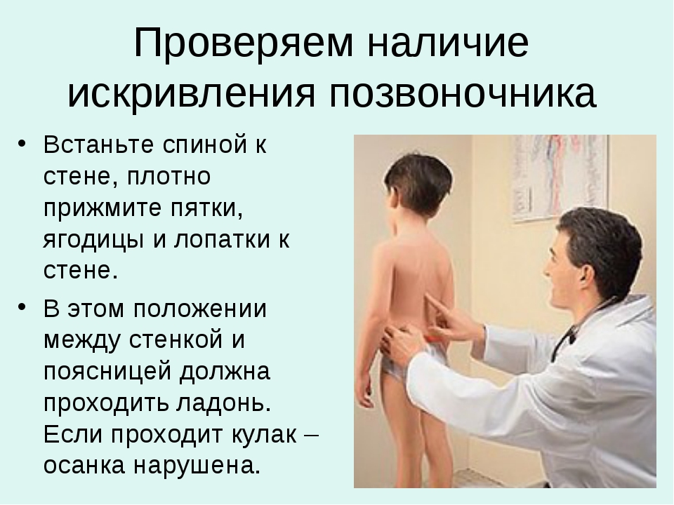 Метод проверки искривления позвоночника